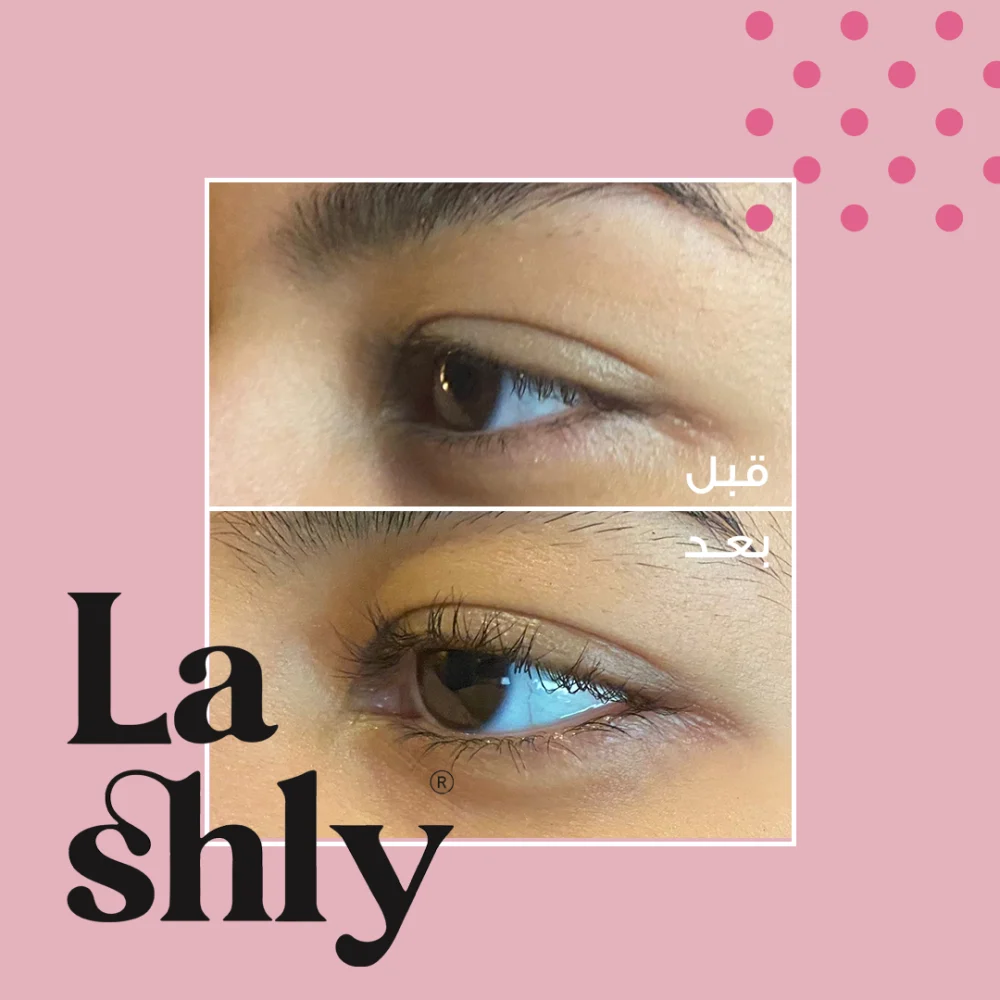 قبل وبعد استخدام سيروم لاشلي